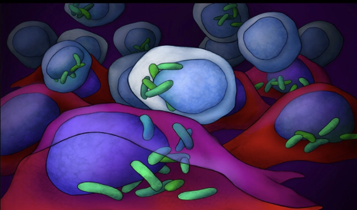 Микробиота и опухоли: новый шаг к пониманию причин канцерогенеза