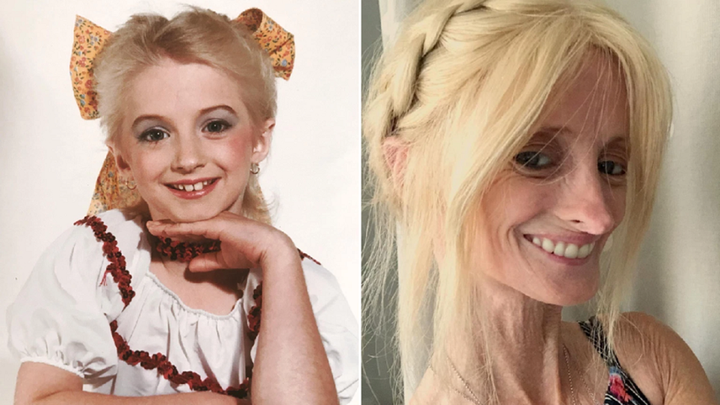 Молодой в старческом обличии