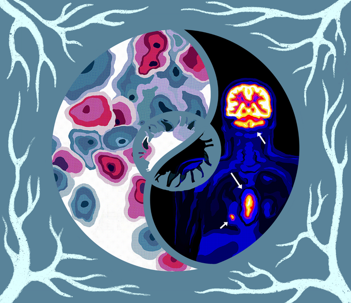 Онкодиагностика — вызовы и решения