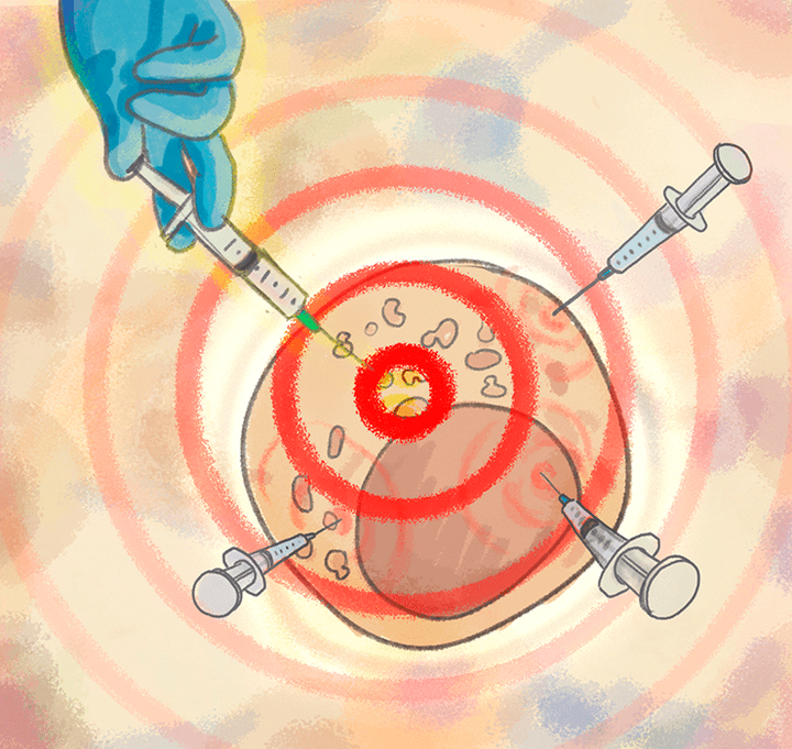 «Обличая порок стяжательства»: можно ли победить болезни накопления генной терапией?