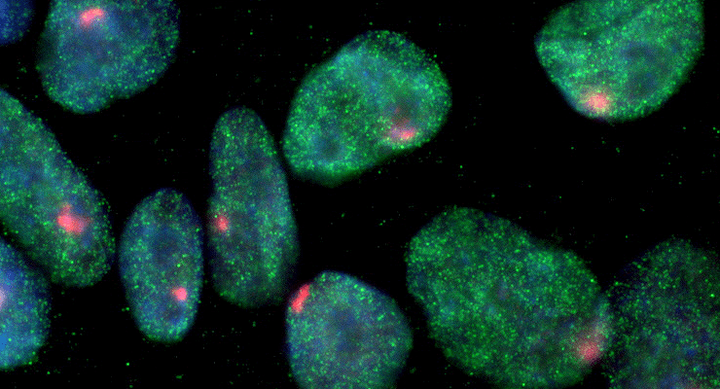 Снежный ком проблем с плюрипотентностью