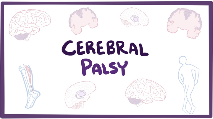 Церебральный паралич — нейробиологические механизмы и факторы риска