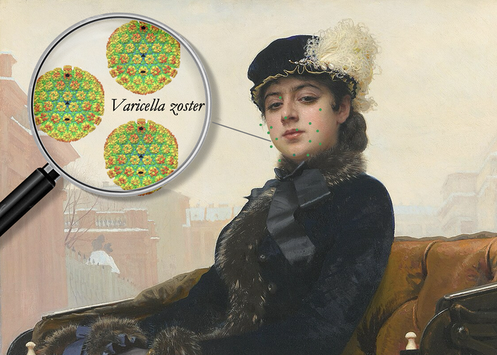 Занесенная ветром: детская болезнь со взрослым характером