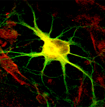 Как сделать нейрон из фибробласта?
