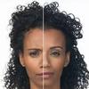 Botox Price Per Unit