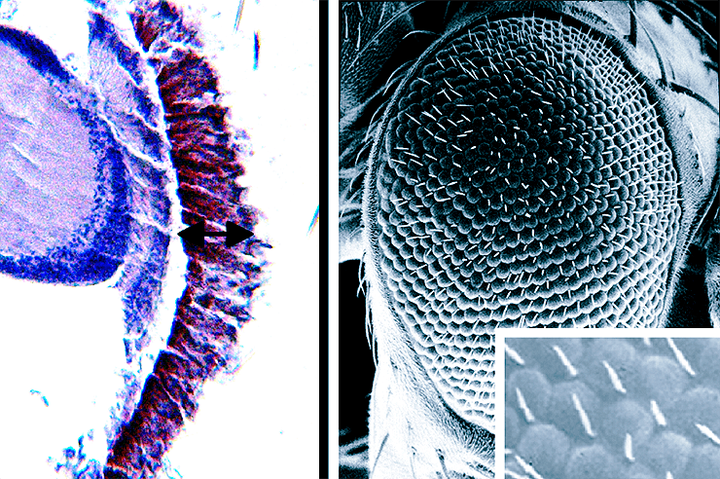 Идентифицированы белки, «слипающиеся» при болезни Гентингтона