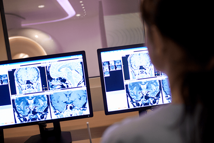 Увидеть то, что неподвластно глазу: как радиомика помогает врачам в диагностике опухолей