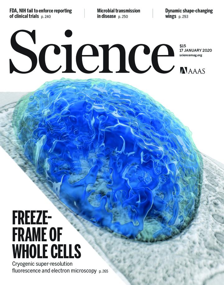 SciNat за январь 2020 #3: новая методика, применяемая в электронной микроскопии, механизмы устойчивости к CRISPR и микробиология неинфекционных заболеваний