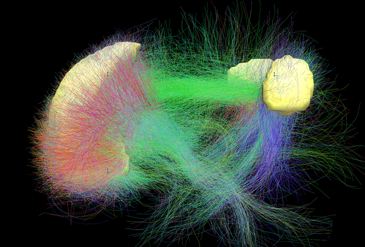 Мозг по дефолту