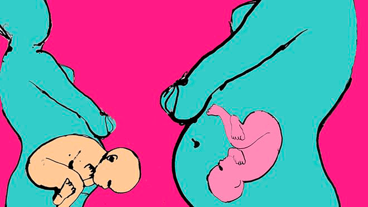 Рожденные кесаревым сечением младенцы не получают ключевых микробов?