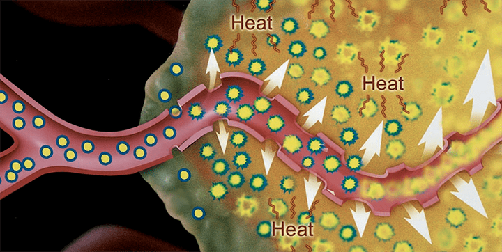 Волшебные пузырьки — липосомы цифелина