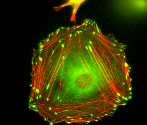 Актиновый цитоскелет и фокальные контакты в фибробластоподобной клетке