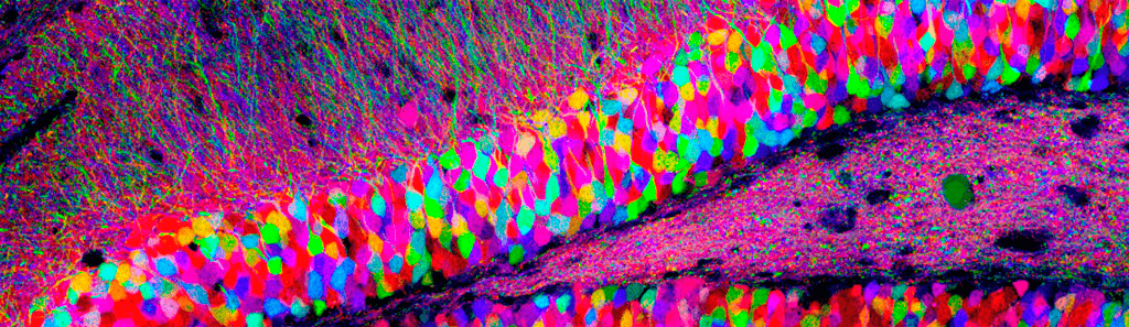 Множество нейронов в срезе гиппокампа крысы