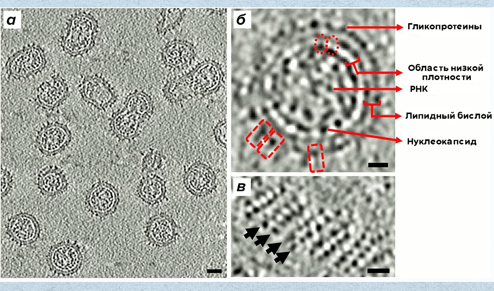 Визуализация частиц вируса краснухи