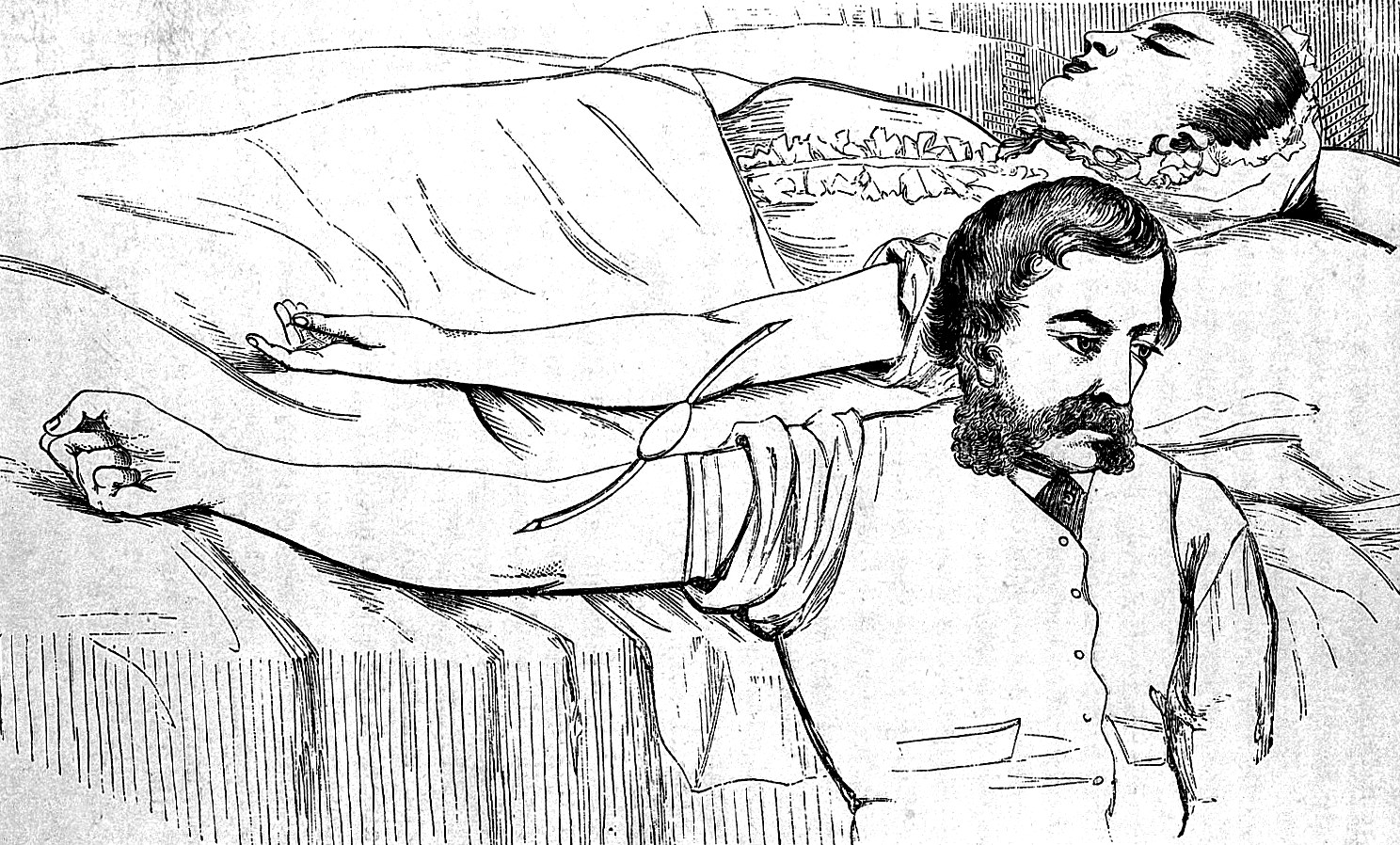 Рисунок из британского медицинского труда 1873 года